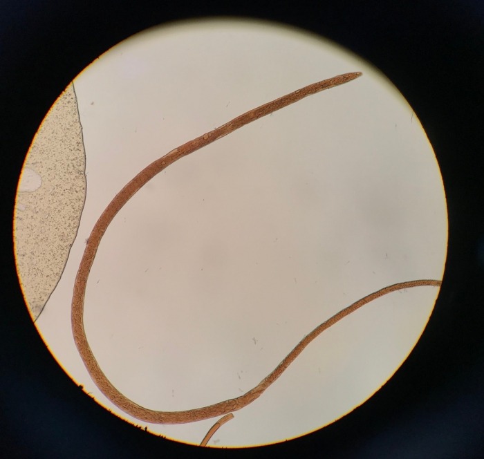 Haarworm onder de microscoop